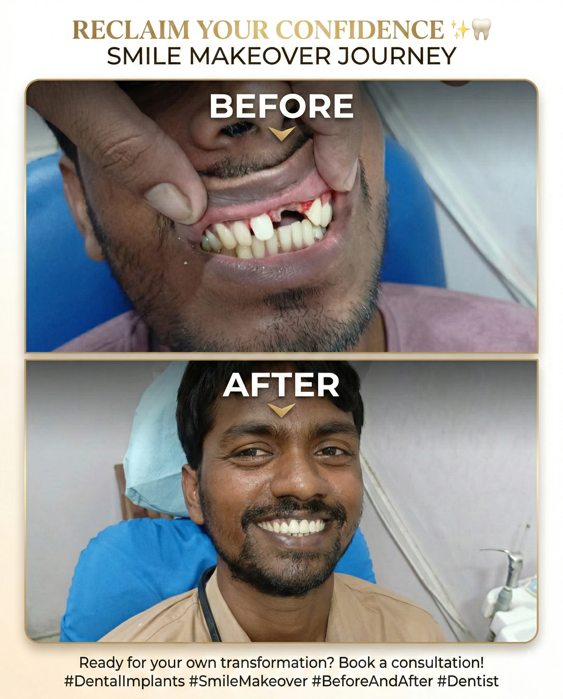 Reclaim Your Confidence: A Complete Smile Transformation