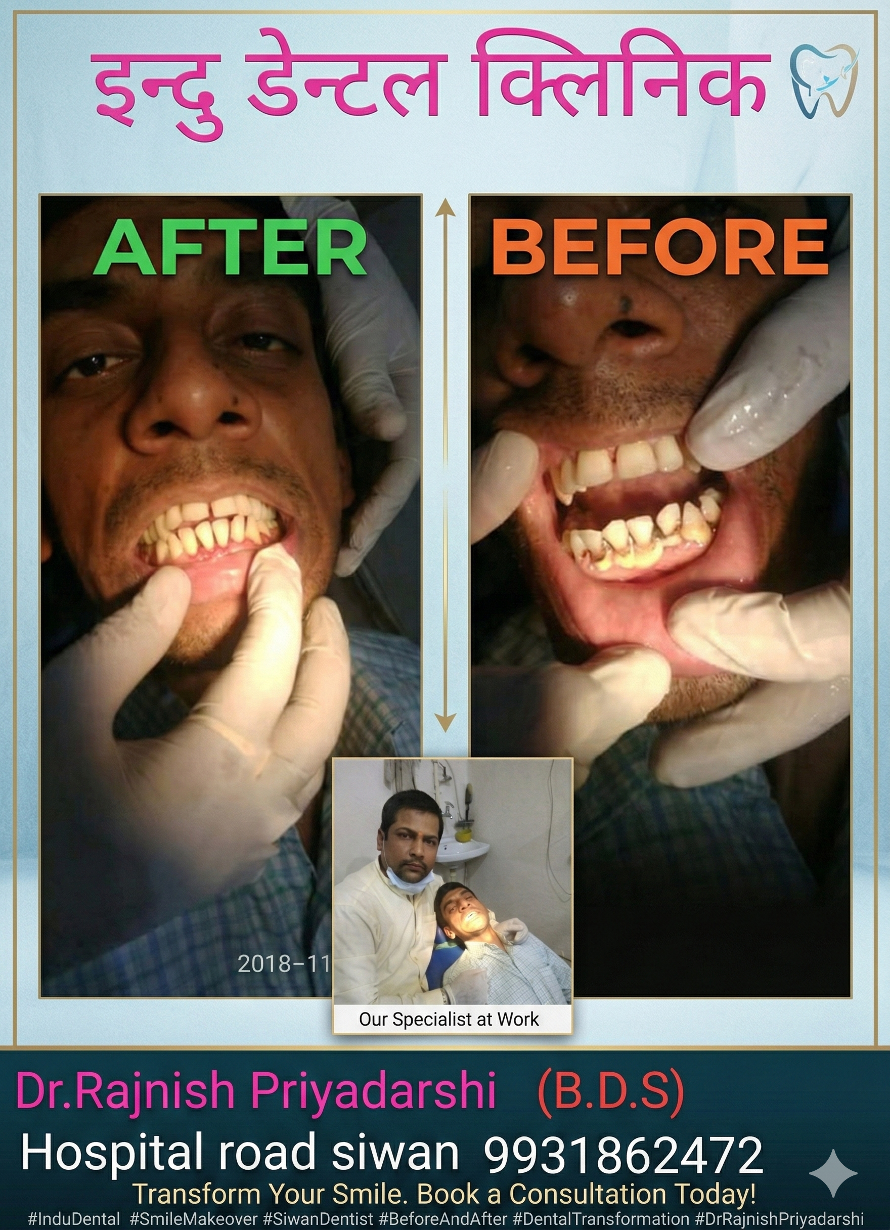 Complete Overhaul: From Severe Decay to Optimal Health